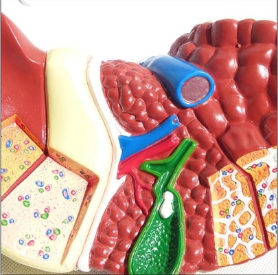 Hepatic Liver Pathological Liver Anatomy 3d Model Easy Preserve Durable