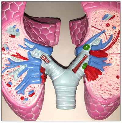 Plastik COPD Paru-Paru Organ Tubuh Manusia Model Visceral Learning 19x13x17cm